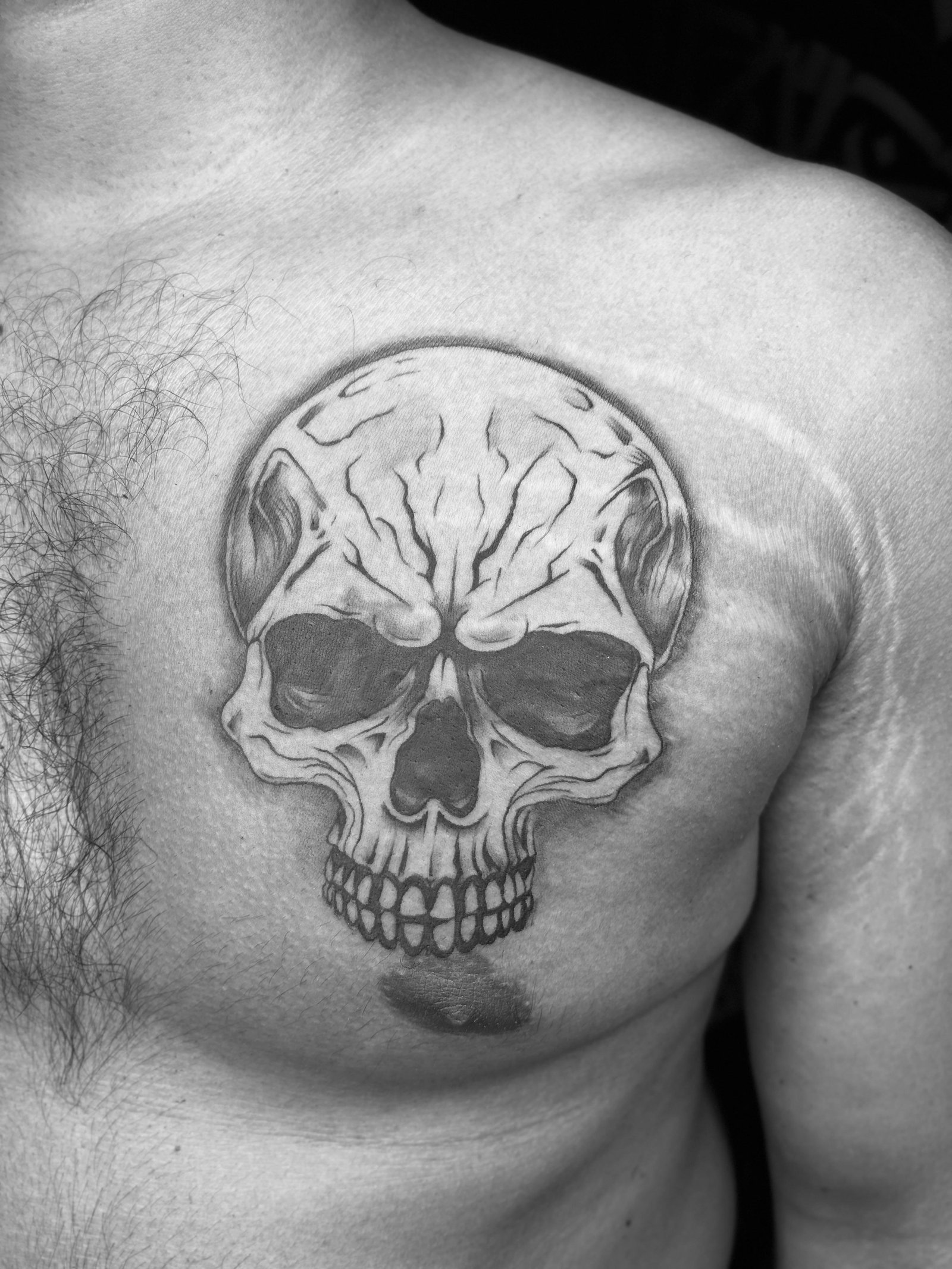 Cover-Up Tattoos